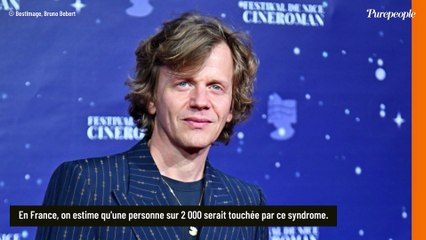 Le père d'Alex Lutz atteint d'un syndrome souvent tourné en dérision qui touche 1 personne sur 2000 en France