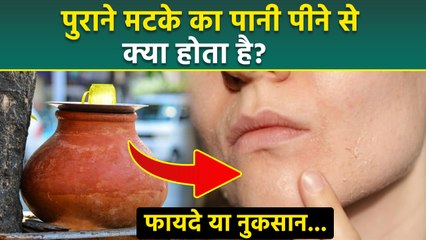 Side Effects Of Old Earthen Pot: पुराने मटके का पानी पीना चाहिए या नहीं, Expert Advice | Boldsky