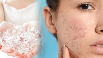Ice Massage Benefits: गर्मियों में Face पर बर्फ लगाने के फायदे,सही तरीका और समय | Boldsky
