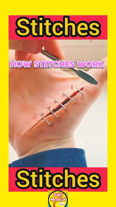 InShot_20250412_222157789