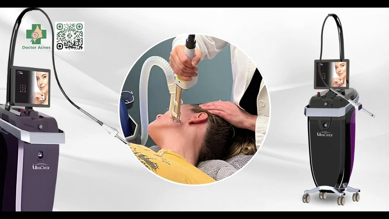 Top các máy laser CO2 fractional tốt nhất hiện nay