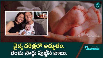 Baby Born Twice - ఒకే బిడ్డకు రెండు సార్లు పురుడు | Oneindia Telugu