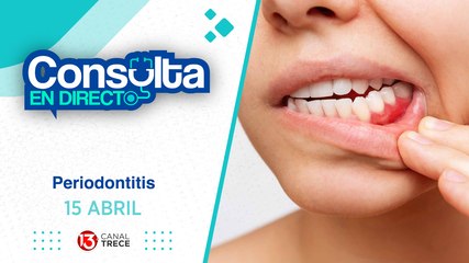 15 Abril 2025 | Consulta en Directo