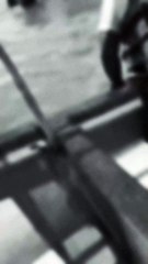 Joven pierde la pierna en accidente en playa de Choluteca