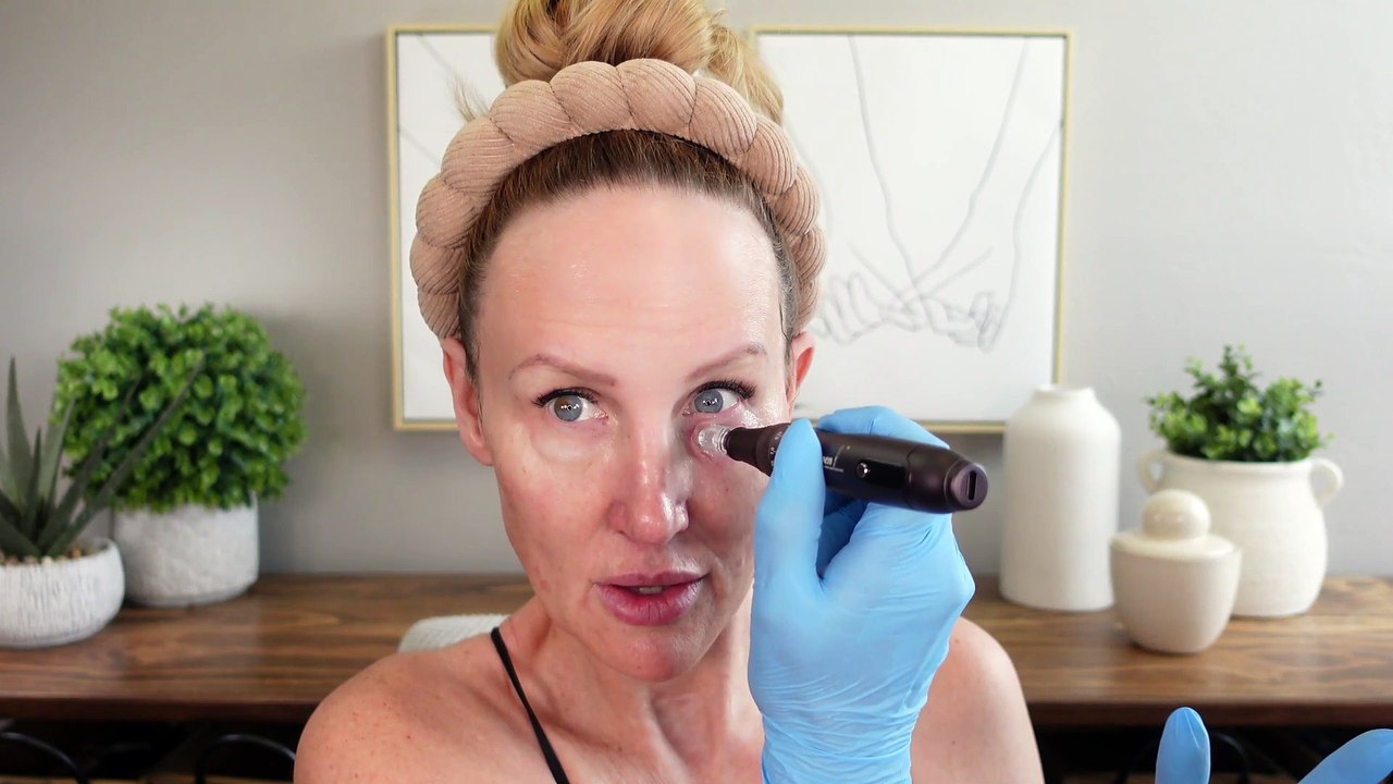 Microneedling at Home // Beginner Friendly Tutorial