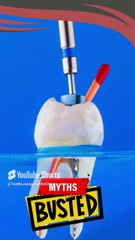 Busting Myths About Root Canal Treatment #healthyteeth #dentist #urbansmilesdentalclinic