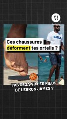 T'as déjà vu les pieds de Lebron James ?!