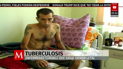 Tuberculosis: Una enfermedad que no debemos olvidar