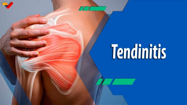 Actitud Saludable | Tendinitis de hombro: síntomas que no se deben ignorar