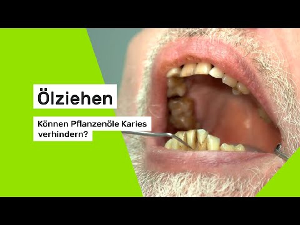 Ölziehen : Können Pflanzenöle Karies verhindern?