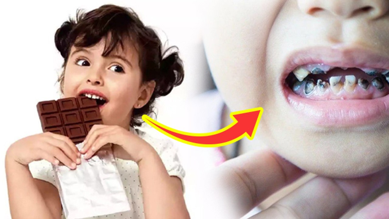 Chocolate Side Effects For Kids: छोटे बच्चों को किस उम्र में चॉकलेट ...