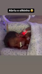 Bia Miranda mostra rosto de Maysha e celebra evolução no quadro de saúde da menina; veja