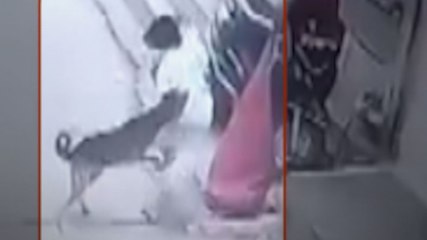 MP: Seoni में बच्ची को आवारा कुत्ते ने नोंचा