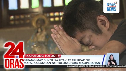 Batang may bukol sa utak at talukap ng mata, kailangan ng tulong para maoperahan | 24 Oras