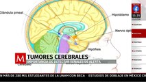 Carlos Cordier, sobreviviente de tumor cerebral nos comparte su historia