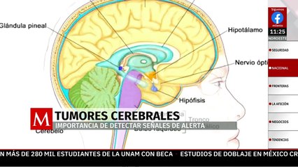 Carlos Cordier, sobreviviente de tumor cerebral nos comparte su historia