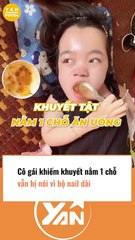 Cô gái khiếm khuyết gây tranh cãi vì bộ nail dài