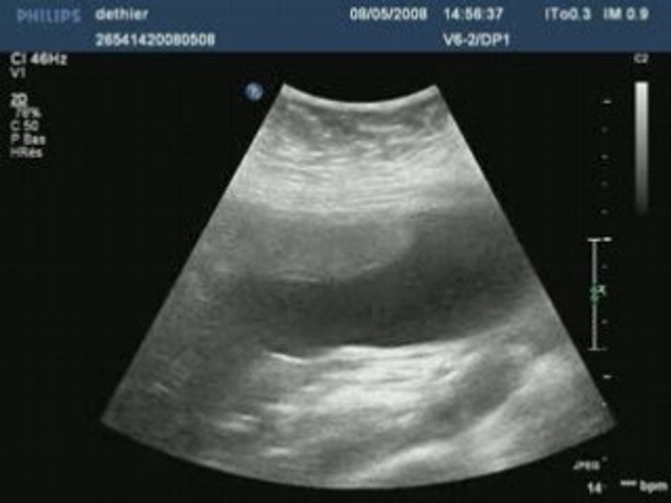 Dethier20080508145637953