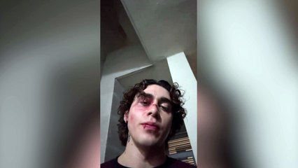 Carlos Belcast y un contratiempo para la Velada del Año 5