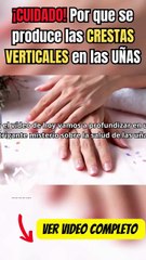 Anatomía de la uña: Lo que NO te enseñan