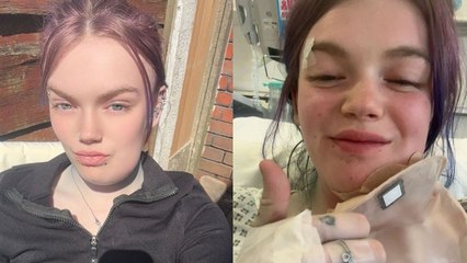 Woman's cracked tooth led to sepsis and left her looking like Family Guy's Quagmire