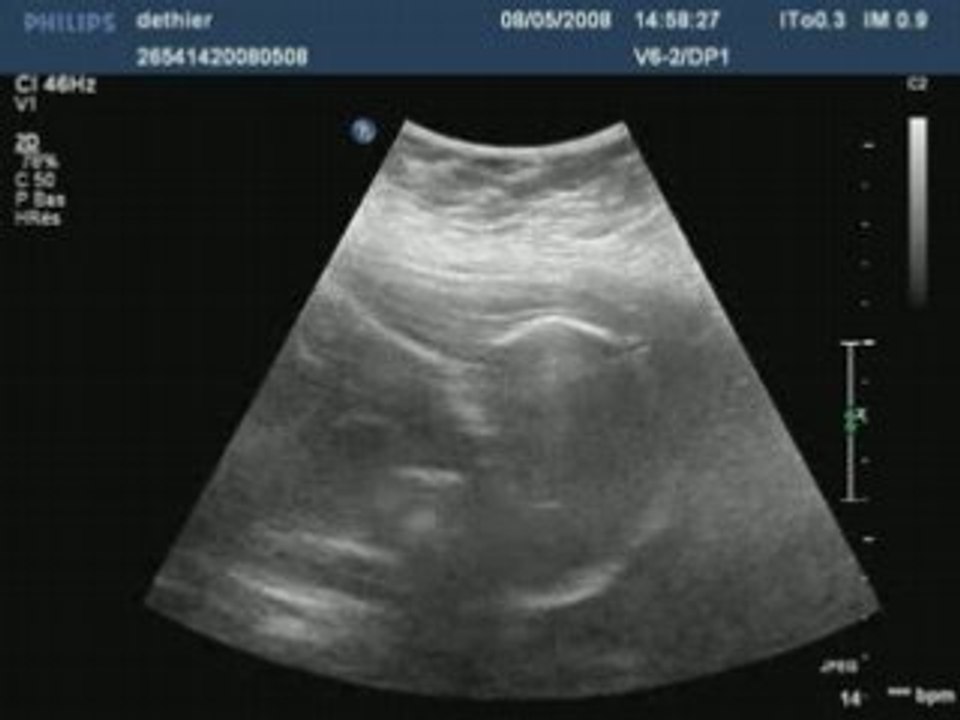 Dethier20080508145827844