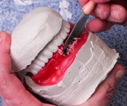 Free Smiles! Dentist Crafts New Teeth for Grandma at No Cost!