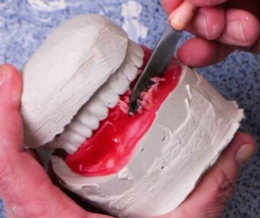 Free Smiles! Dentist Crafts New Teeth for Grandma at No Cost!
