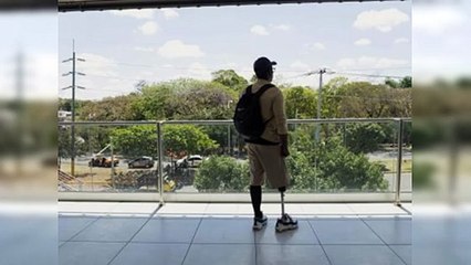 La fabricación de prótesis con impresión 3D del ITLA