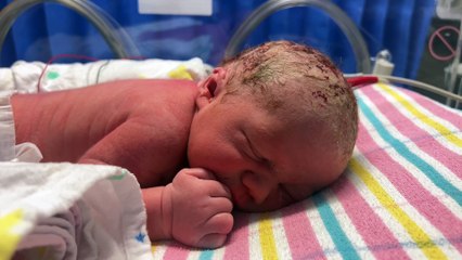 Newborn Baby Boy’s Hunger Cues in Humidicrib Hours After Birth ||