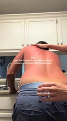 Man Ends up Extremely Sunburned After Six Hours of Boating