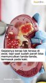 5 Tanda Gagal Ginjal yang Terlihat pada Kaki, Kenali Cirinya