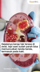 5 Tanda Gagal Ginjal yang Terlihat pada Kaki, Kenali Cirinya