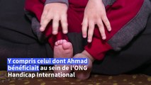 Jordanie: Ahmad, 5 ans, porteur d'un lourd handicap, souffre des coupes de l'aide américaine