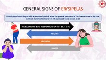 General signs (symptoms) of erysipelas
