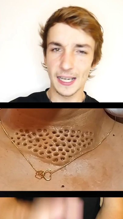 La trypophobie 🤯
