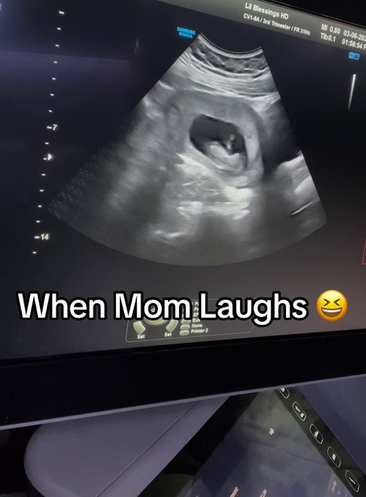 My Bad