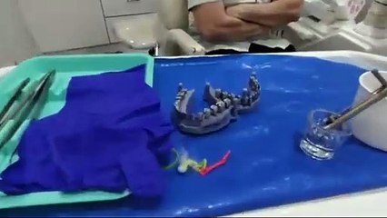 Getting Dental Implants in Mumbai_ My Experience in India!