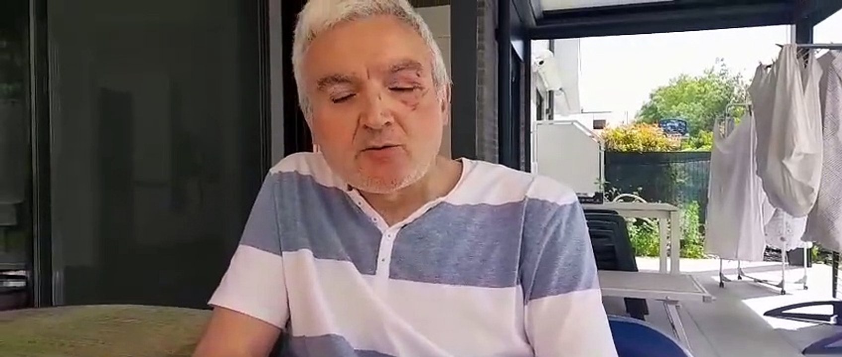 Aggressione nel quartiere Acque Chiare: l'intervista a Luciano Palmiotto, l'uomo aggredito