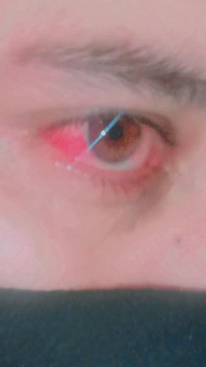 pain full eyes