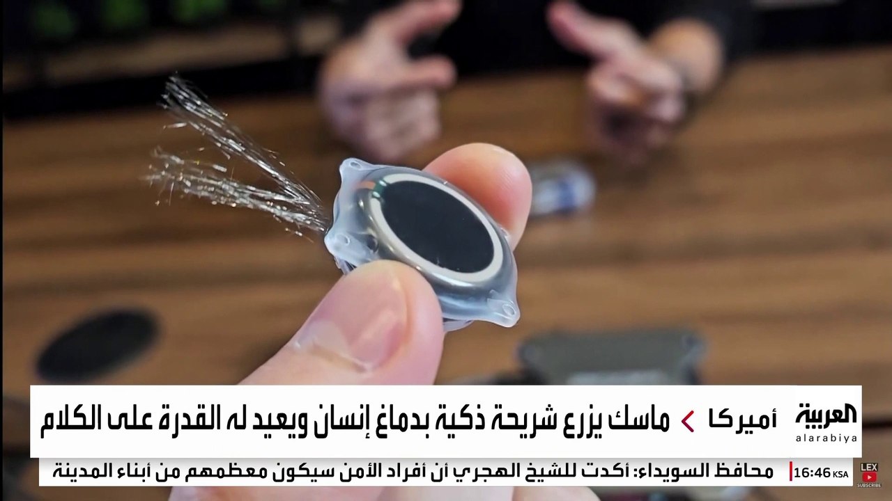 ماسك يزرع شريحة ذكية في دماغ إنسان ويعيد له قدرة النطق