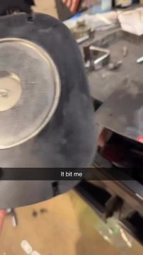 Man's Finger Get Trapped Between Strong Magnets