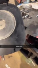 Man's Finger Get Trapped Between Strong Magnets