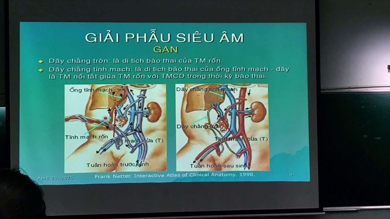 Giải phẫu siêu âm