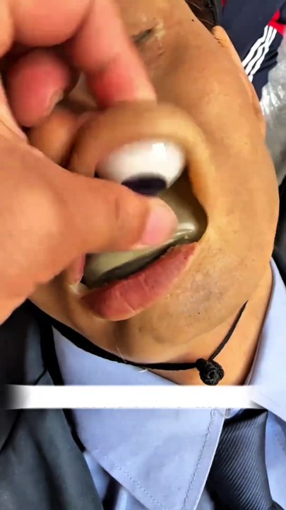😳
