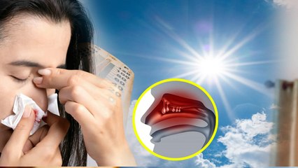Causes of Nose Bleeding in Summer:गर्मियों में नाक से खून क्यों आता है,Treatment In Hindi | Boldsky