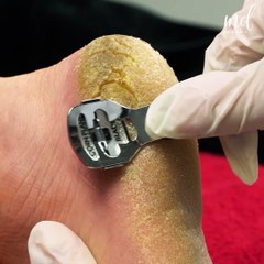 The summer pedicure transformation we need!