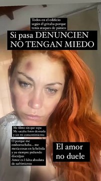 Lourdes de Bandana acusó a su expareja de violencia de género