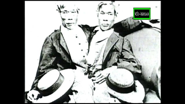 Horizontes Científicos: Gemelos Siameses - Documental (1995) - Español Latino