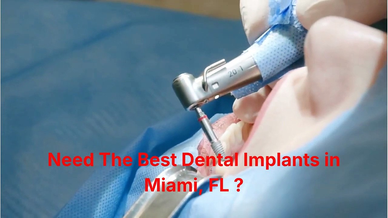 Elite Smiles Dental Center : Dental Implants in Miami, FL